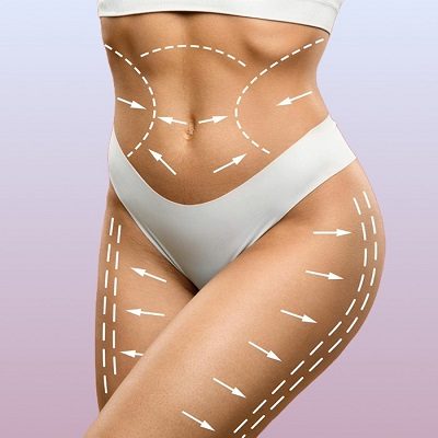 What Are The Different Types of Body Fillers in Islamabad?