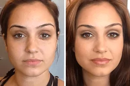 Glutathione Injection Before & After