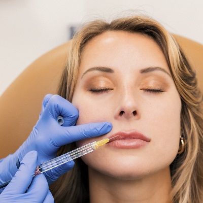 Top Lip Line Filler Islamabad