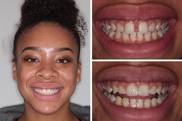 Cosmetic Dentistry Before & After clinic islamabad