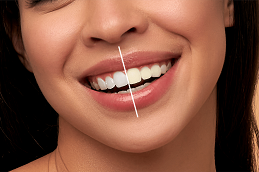 Results OF Dentistry Pakistan