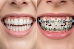Results OF Dentistry clinic Islamabad