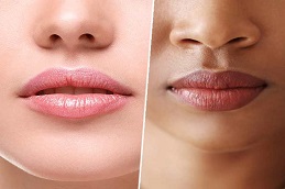 Results OF Pico Laser Treatment for Dark Lips clinic Islamabad