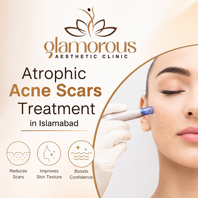 Atrophic Acne Scars Treatment in Islamabad