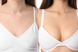 Breast Fillers Before and After clinic in Pakistan