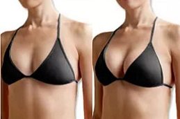 Breast Fillers Before and After clinic islamabad