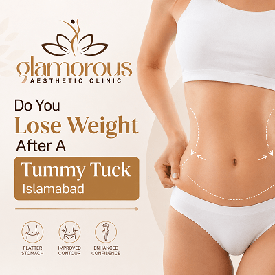 Do You Lose Weight After A Tummy Tuck