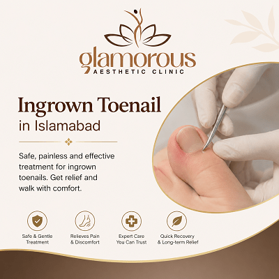 Ingrown Toenail in Islamabad Pakistan