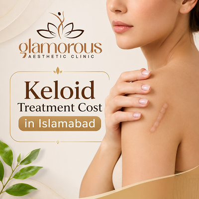 Keloid Treatment Cost in Islamabad