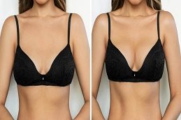 Results OF Breast Surgery Islamabad Pakistan