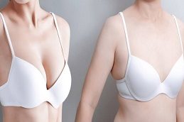 Results OF Breast Surgery clinic Islamabad Pakistan