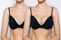 Results OF Breast Surgery clinic Islamabad