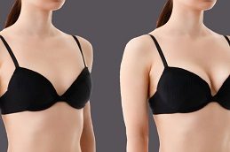 Results OF Breast Surgery clinic in Islamabad Pakistan