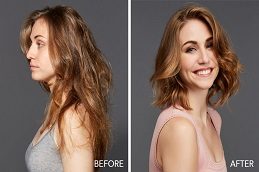 Results OF Female Haircut Clinic in Islamabad Pakistan