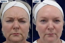 Results OF Steroid Injections clinic islamabad