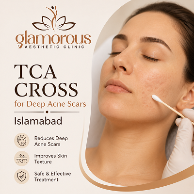 TCA CROSS for Deep Acne Scars Islamabad