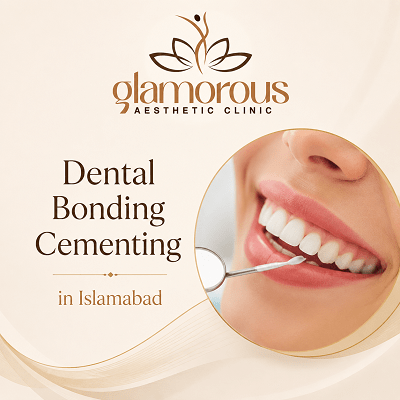 Dental Bonding Cementing in Islamabad Pakistan