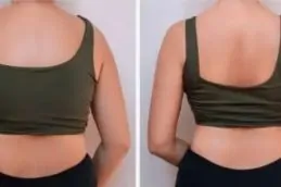 Results OF Weight Loss Injections in Pakistan