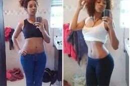 Weight Loss Injections Before & After in Pakistan