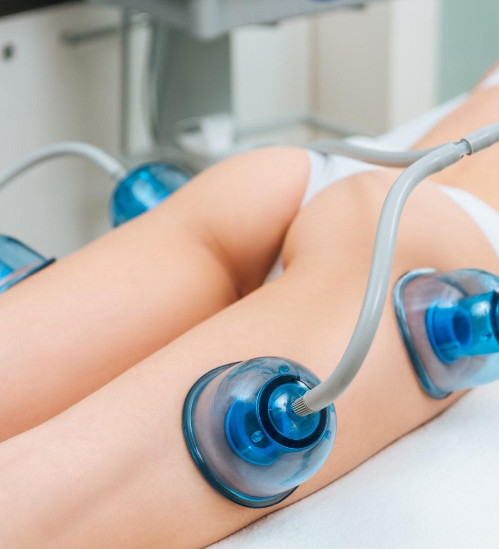 selective-focus-of-woman-with-cupping-cups-on-legs-and-buttocks.jpg selective-focus-of-woman-with-cupping-cups-on-legs-and-buttocks.jpg